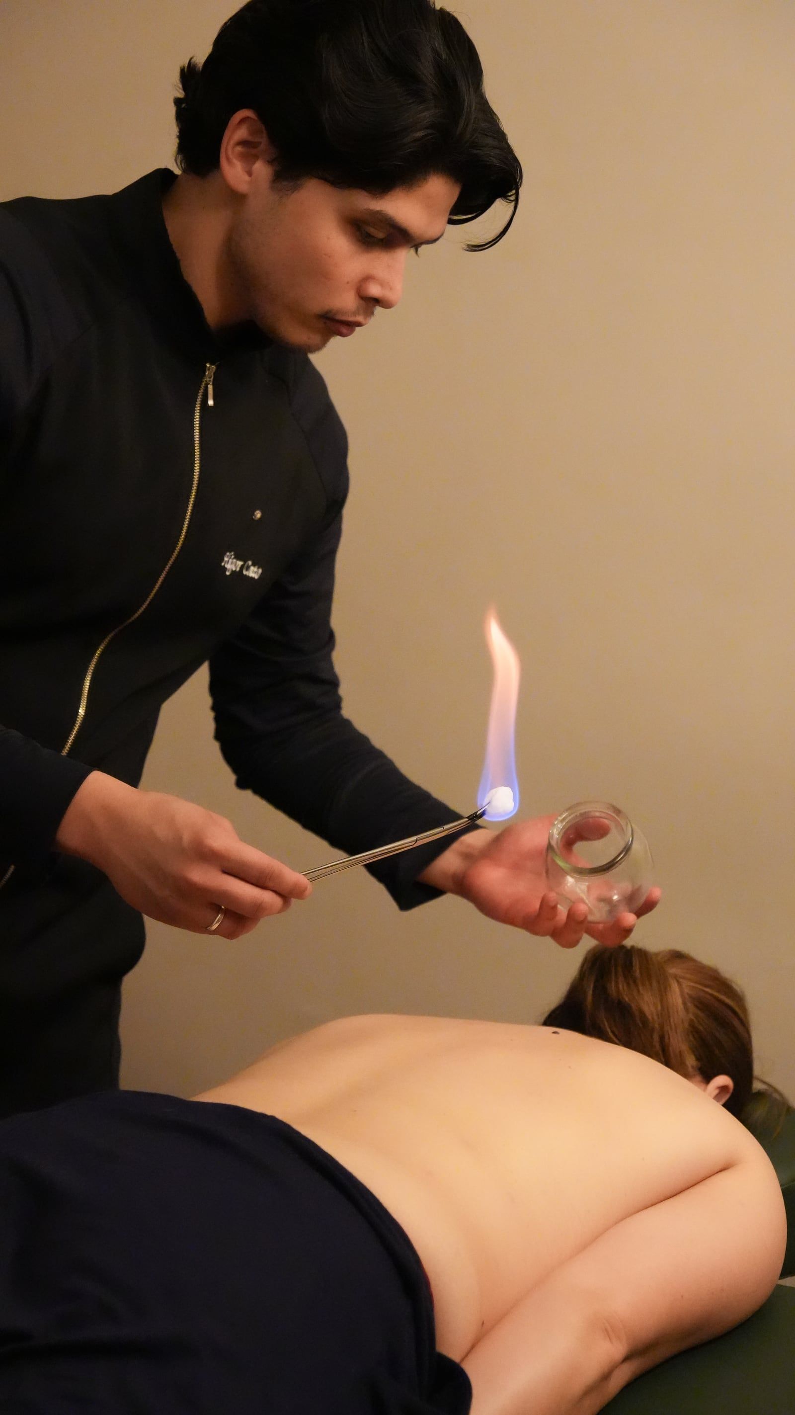 Higor Couto preparando uma ventosa de vidro com fogo, ao lado da paciente deitada